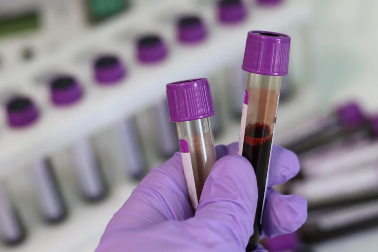 A gloved hand holds blood sample tubes in an Ambetter covered medical clinic lab.
