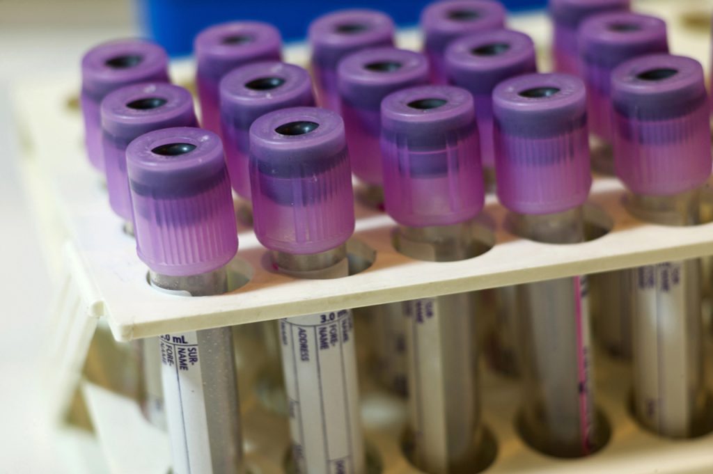 Medical laboratory blood collection tubes for diagnostic testing at a walk-in clinic Ambetter insurance Houston